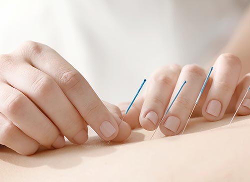 About Grace Li, Acupuncture Clinic in Canterbury